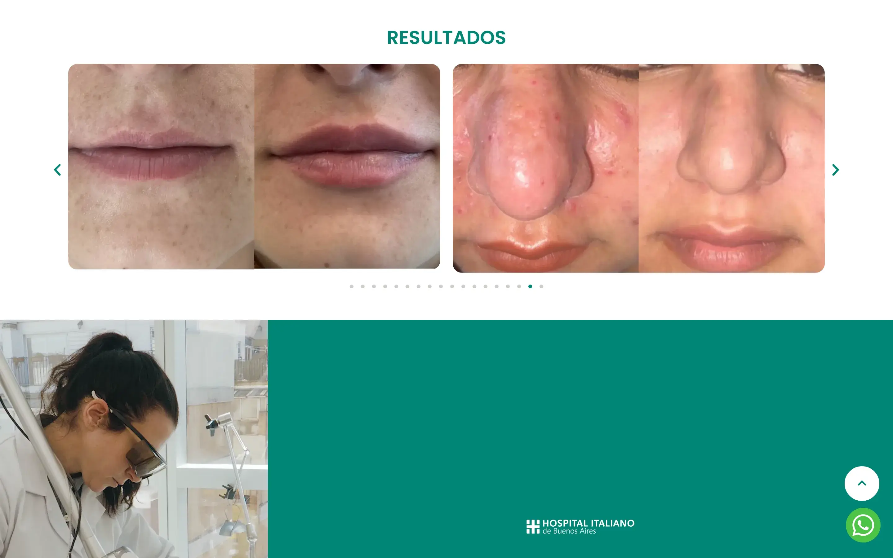 Resultados · carrusel antes/después (18 fotos)